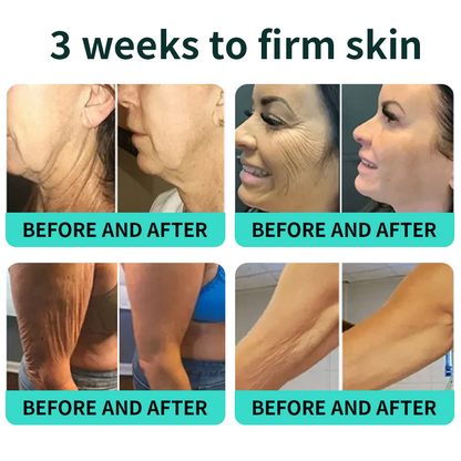 Vitalisys® PDRN Complex Peptide Capsule Cream|Anti aging, firming and lifting muscles Skin care, removal of stretch marks, breast enhancement, removal of chest lines, and skin repair.