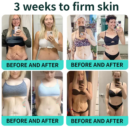 Vitalisys® PDRN Complex Peptide Capsule Cream|Anti aging, firming and lifting muscles Skin care, removal of stretch marks, breast enhancement, removal of chest lines, and skin repair.